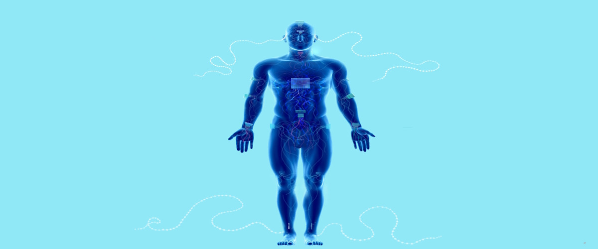 ¿Quién coloca y cómo los dispositivos que llamamos «implantes etéricos» y cuál es la razón para hacerlo?
